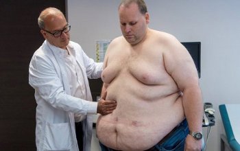 патологическое ожирение